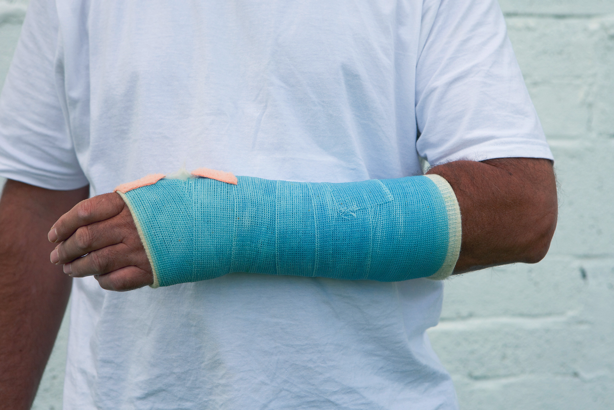 Common Injuries